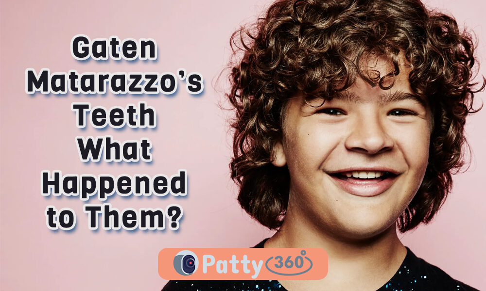 Gaten Matarazzo’s Teeth: What Happened to Them? - Patty360
