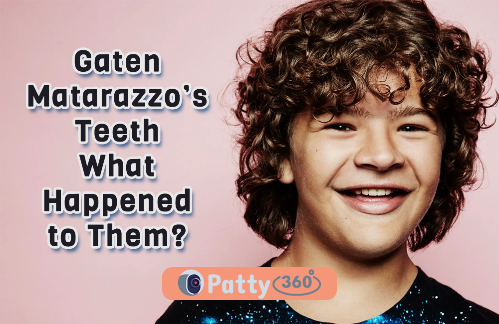 Gaten Matarazzos Teeth What Happened To Them Patty360 9362